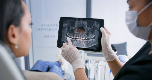 Licensed Teeth Whitening service in North Fort Lewis, WA - Smile Center Dentistry